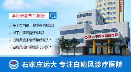 青年患白癜风的原因是什么