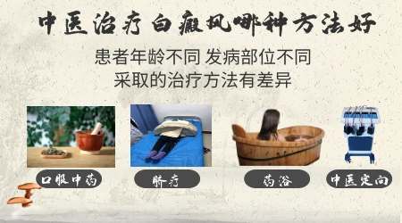 石家庄治疗白癜风的中西医结合医院