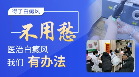 伍德灯检查白癜风准不准 会误诊吗