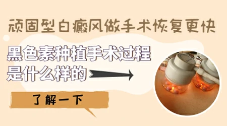 白癜风种植后取皮的地方会留疤吗