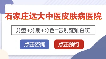 背上有一块白色的皮肤没有什么感觉怎么回事