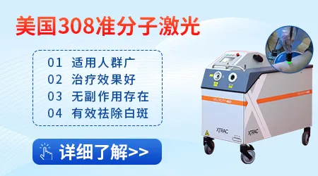 白斑用308激光治疗效果怎么样