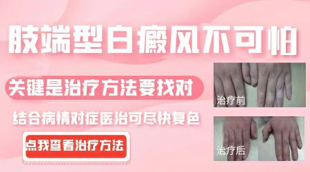 手脚上的白癜风白斑为什么周期相对长一些