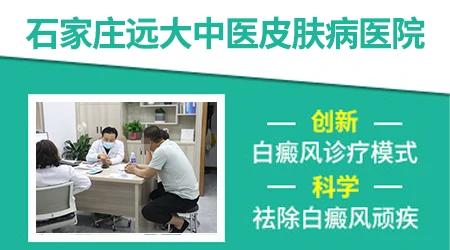 伍德灯检查能直接排除所有白斑病吗