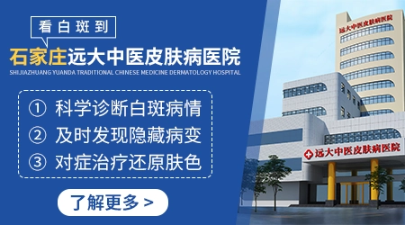 石家庄治疗白癜风排名前十医院