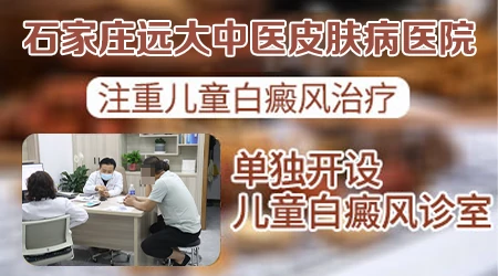 石家庄治疗儿童白癜风好的医院
