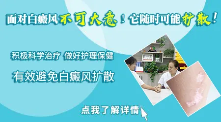 无色素痣白斑会不会扩散