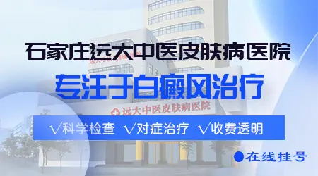 石家庄治白癜风去哪个医院