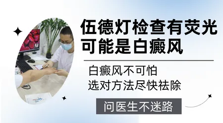 皮肤CT比伍德灯检查白斑更准确吗