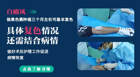 自体表皮移植治疗白斑靠谱吗