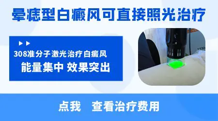 晕痣先祛痣还是先治周围白斑