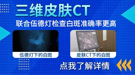 太阳穴部位有块花生大的白斑什么情况