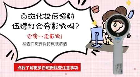 照伍德灯前擦药会影响白斑检查结果吗