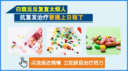 白癜风抗复发吃什么药好