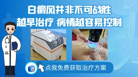 白癜风初期能不能除根