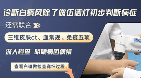 脸颊两侧对称白斑是怎么回事