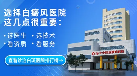 石家庄哪个医院看白癜风看得好