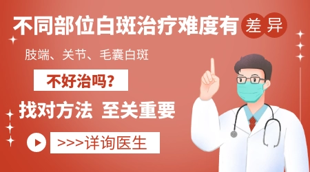 白癜风治好后颜色会和原来完全一样吗