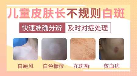 儿童身上出现小白斑是不是白癜风