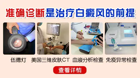 怎么分辨身上的白斑是不是白癜风