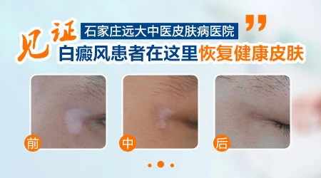 皮肤有白点不疼不痒怎么回事