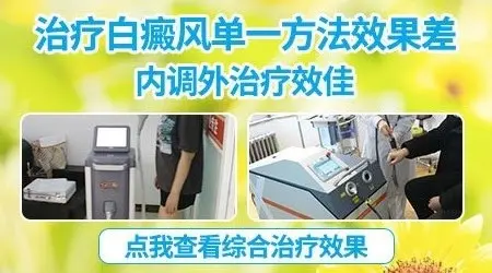 白癜风打复色针要打几次才能见效