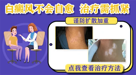 刚长白癜风面积小有自愈的可能吗