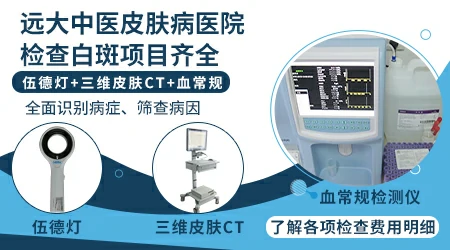 伍德灯照出来高度怀疑白癜风怎么办