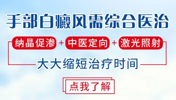 石家庄手部顽固型白癜风去哪能治