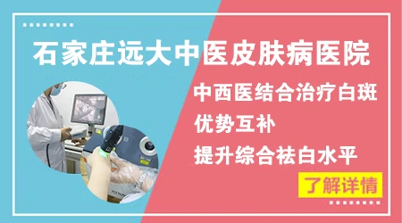 白癜风他克莫司软膏长期涂会不会产生耐药性