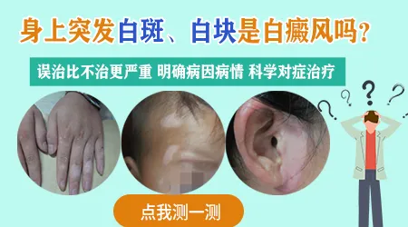 如何自我判断是不是白癜风