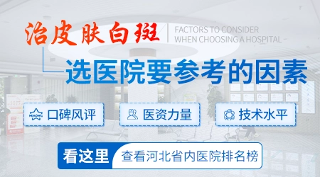 石家庄看皮肤白斑去哪家医院好