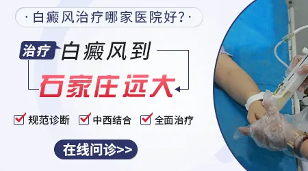 石家庄哪家医院看白癜风治愈率高