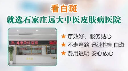 伍德灯下呈灰白色是什么情况