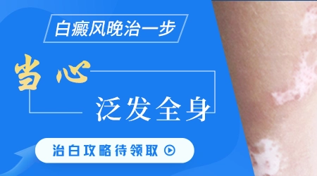 白癜风发病前期有什么征兆