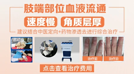 手脚白癜风石家庄哪家医院看得好