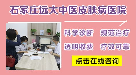 白色糠疹和白癜风在伍德灯下怎么区分