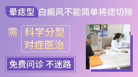 晕痣白癜风能不能治好 怎么治疗好