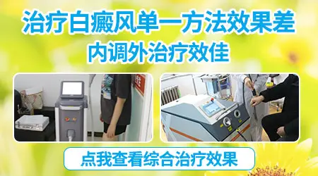 给白斑涂药的时候要避开正常皮肤吗