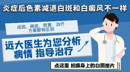 炎症后色素减退和白癜风是一回事吗