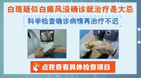 伍德灯照出来高度怀疑白癜风怎么办