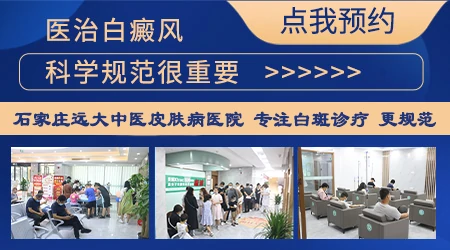 石家庄哪家医院专门治白癜风