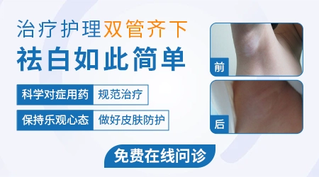 石家庄哪里有专门治疗白癜风的