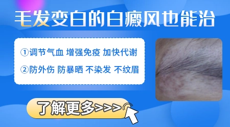 白癜风长在眉眼部位眉毛变白还能恢复吗