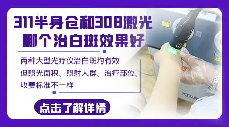 白癜风308准分子激光和UVB光疗该怎么选