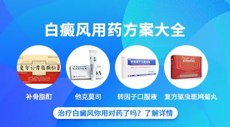 白癜风初期用什么药物效果好