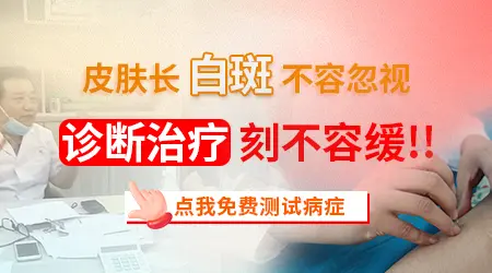 军训暴晒后脸上长白点是不是白癜风