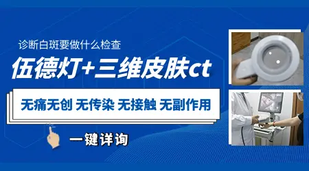 脸上长了一小块白斑是什么原因