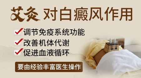 中医艾灸对白癜风恢复效果大吗