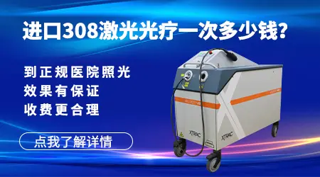 石家庄白癜风专科医院照激光怎么收费
